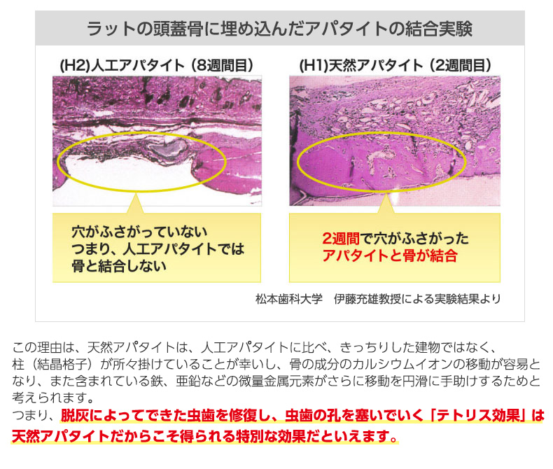 脱灰によってできた虫歯を修復し、虫歯の孔を塞いでいく「テトリス効果」は天然アパタイトだからこそ得られる特別な効果だといえます。